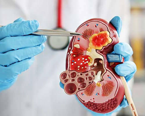 Nephrology